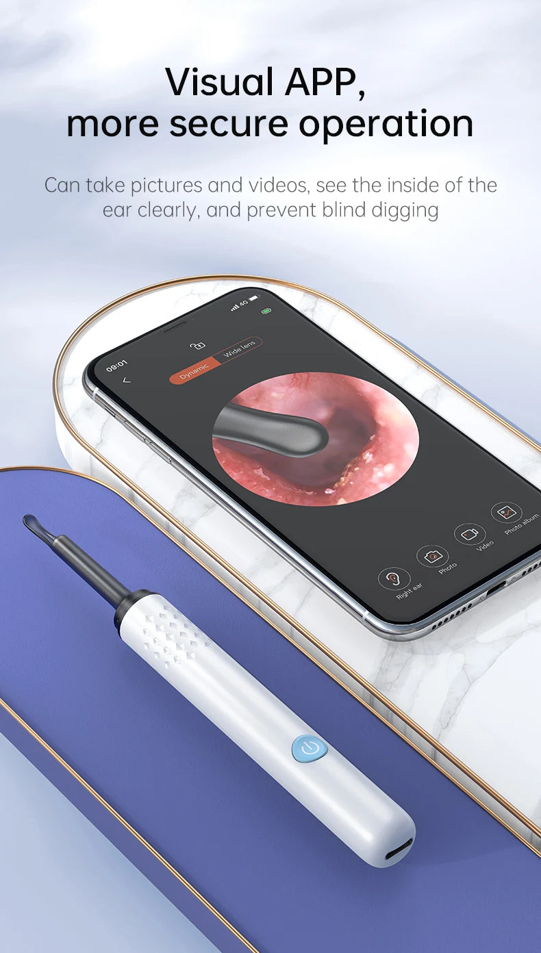 WIFI Ear Cleaner Otoscope Camera - 6 LED, 500W HD Video Ear Wax Removal Tool