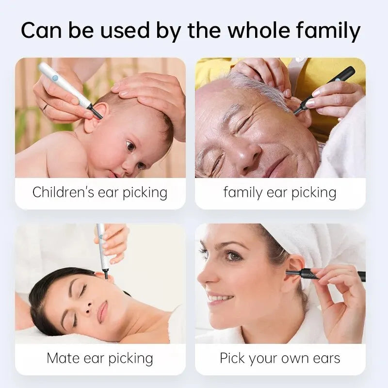 WIFI Ear Cleaner Otoscope Camera - 6 LED, 500W HD Video Ear Wax Removal Tool