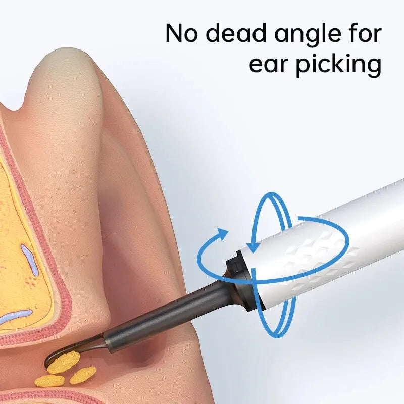 WIFI Ear Cleaner Otoscope Camera - 6 LED, 500W HD Video Ear Wax Removal Tool