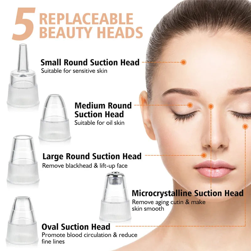 Blackhead Remover & Pore Vacuum Suction Tool - Acne & Facial Dermabrasion