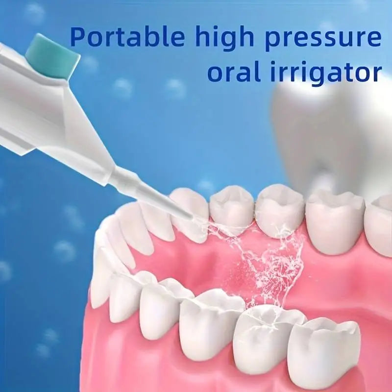 Portable High-Pressure Oral Irrigator - Teeth Cleaner & Water Floss