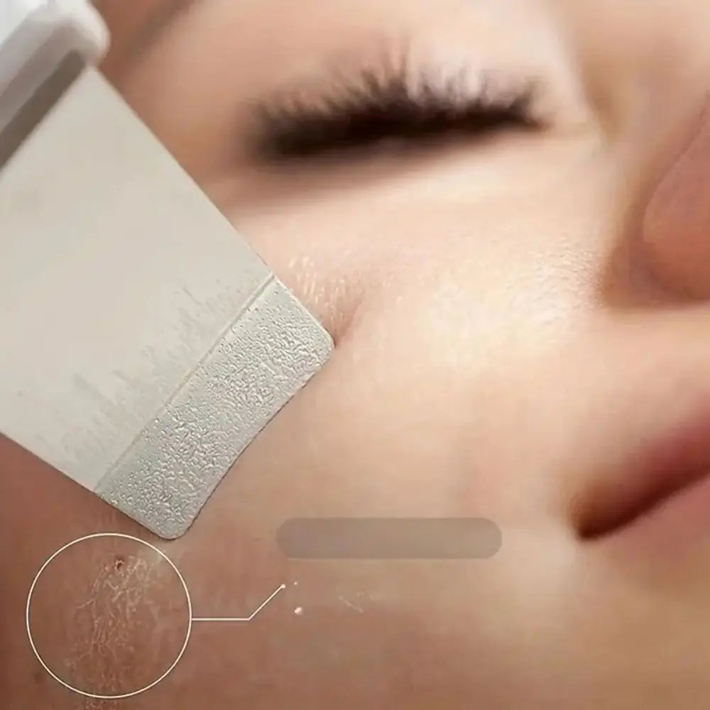Ultrasonic Skin Scraper Pore Cleaning Facial Deep Cleaning Machine Suitable for Female and Male