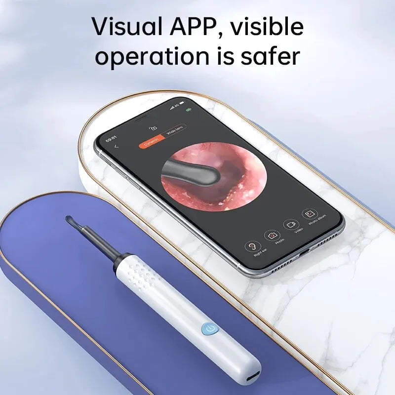 WIFI Ear Cleaner Otoscope Camera - 6 LED, 500W HD Video Ear Wax Removal Tool
